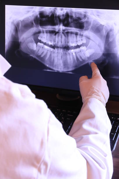 Best Emergency Wisdom Teeth Removal in West Park, FL